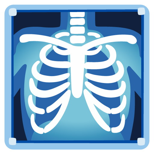X-Ray as drawn by Google in 15.0